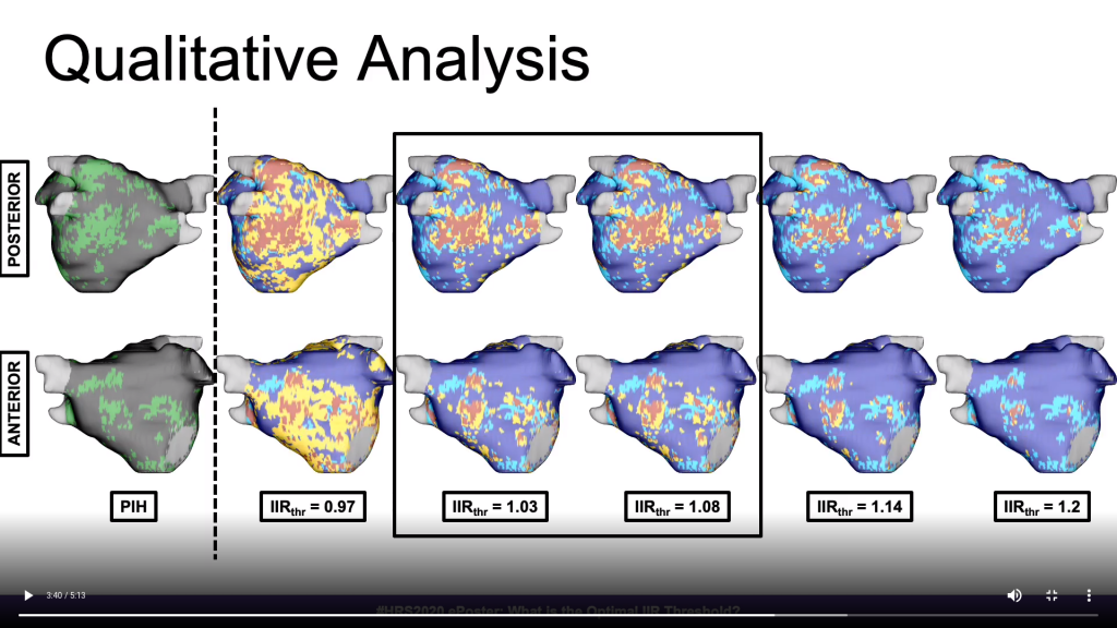 Pat's e-Poster from HRS2020