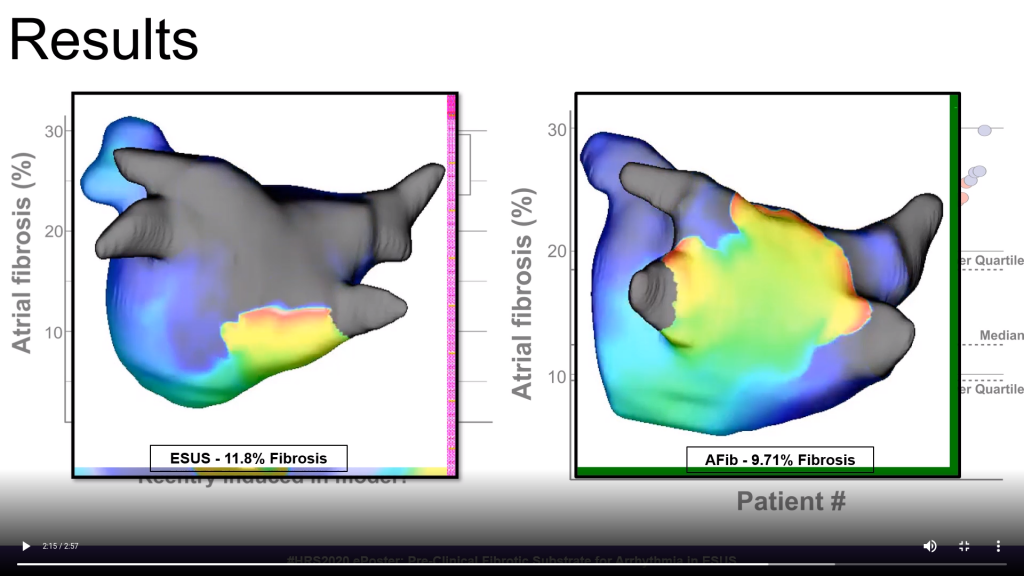 Savannah's e-Poster from HRS2020
