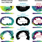Activation maps showing: ectopic beating, optogenetic suppression of ectopy, and continuation of sinus-like excitation despite light therapy
