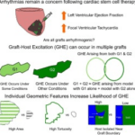 Injection of cells into infarcted region; differences in graft shape underlying variability in graft-host excitation (GHE); high vs. low isolatedness