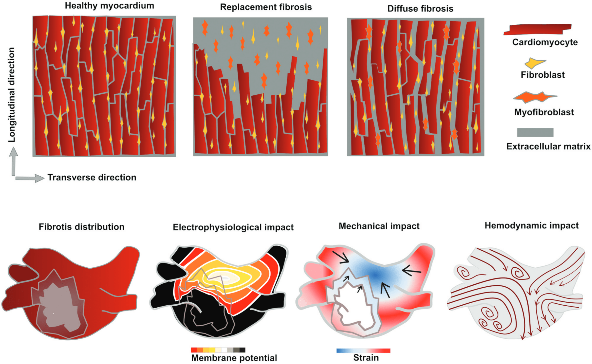 Schematic drawings of fibrotic remodeling on cell-scale and physiological impact on organ-scale.