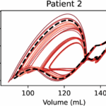 Pressure-volume (PV) loops from all fractional factorial design (FFD) combinations, for all three patients. Baseline PV loops are displayed with a bolder black dotted line, while the thinner red traces correspond to FFD combinations. From Telle et al. (2025) PLoS Comput Biol