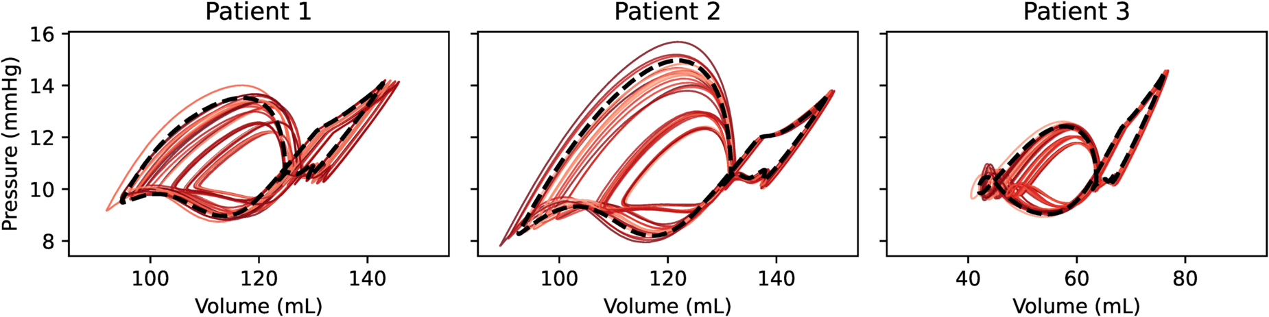 Pressure-volume (PV) loops from all fractional factorial design (FFD) combinations, for all three patients. Baseline PV loops are displayed with a bolder black dotted line, while the thinner red traces correspond to FFD combinations. From Telle et al. (2025) PLoS Comput Biol